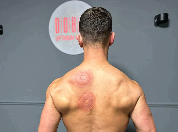 SmartCup Cupping Therapy Device