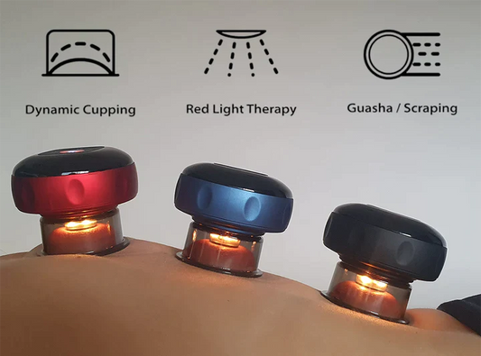 SmartCup Cupping Therapy Device